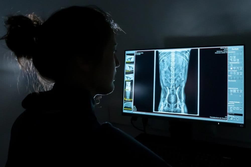 Röntgenuntersuchung Symbolbild